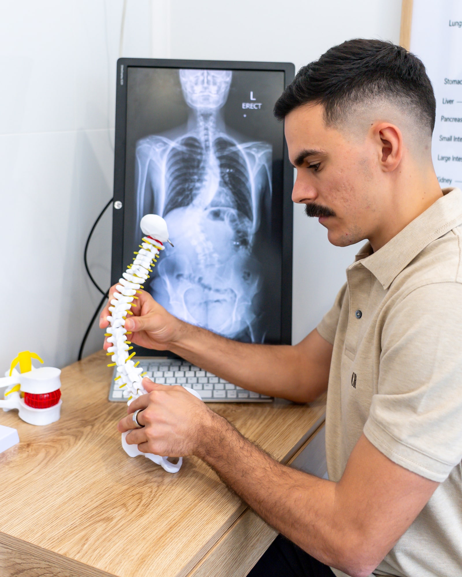 Alma Health chiropractor explaining spinal care with a spine model and X-ray